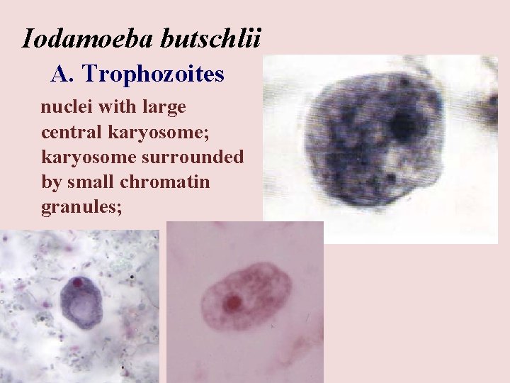 Iodamoeba butschlii A. Trophozoites nuclei with large central karyosome; karyosome surrounded by small chromatin