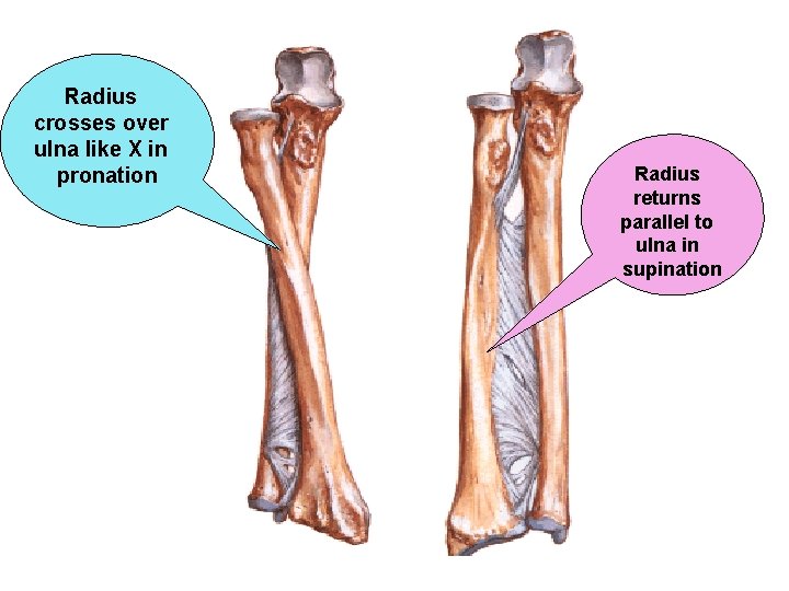 Radius crosses over ulna like X in pronation Radius returns parallel to ulna in