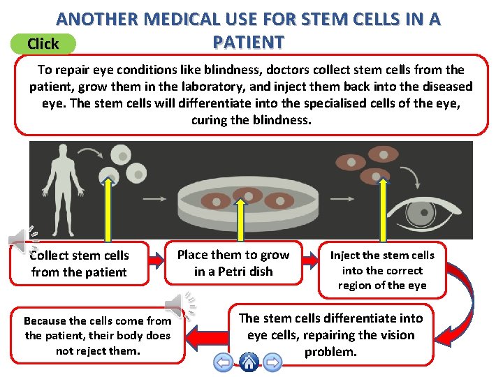 ANOTHER MEDICAL USE FOR STEM CELLS IN A PATIENT Click To repair eye conditions