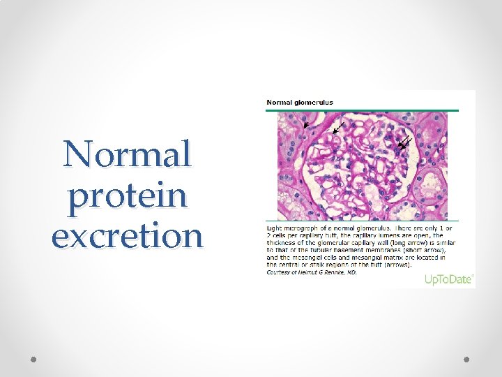 Normal protein excretion 