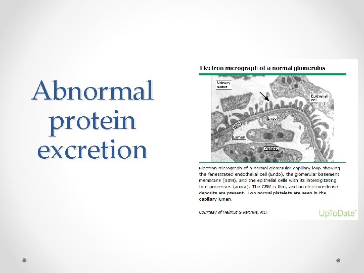 Abnormal protein excretion 