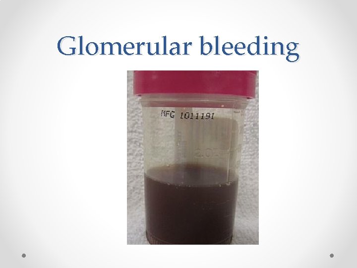 Glomerular bleeding 