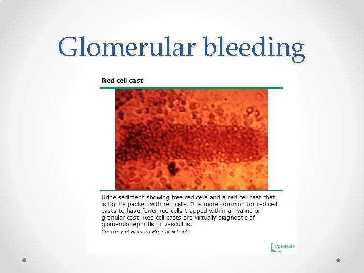 Glomerular bleeding 