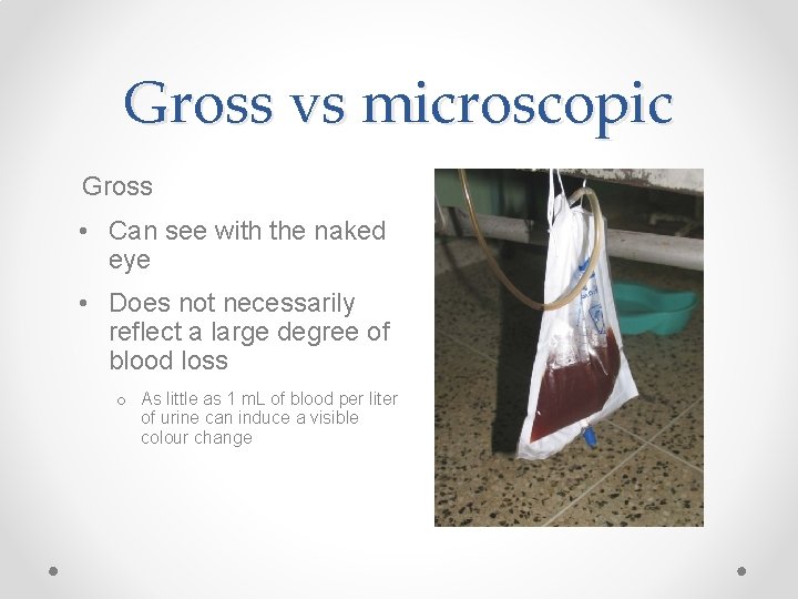 Gross vs microscopic Gross • Can see with the naked eye • Does not