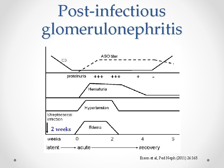 Post-infectious glomerulonephritis 2 weeks Eison et al, Ped Neph (2011) 26: 165 