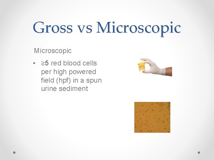 Gross vs Microscopic • ≥ 5 red blood cells per high powered field (hpf)