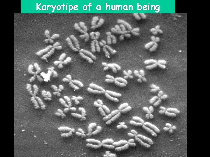 Karyotipe of a human being 12 