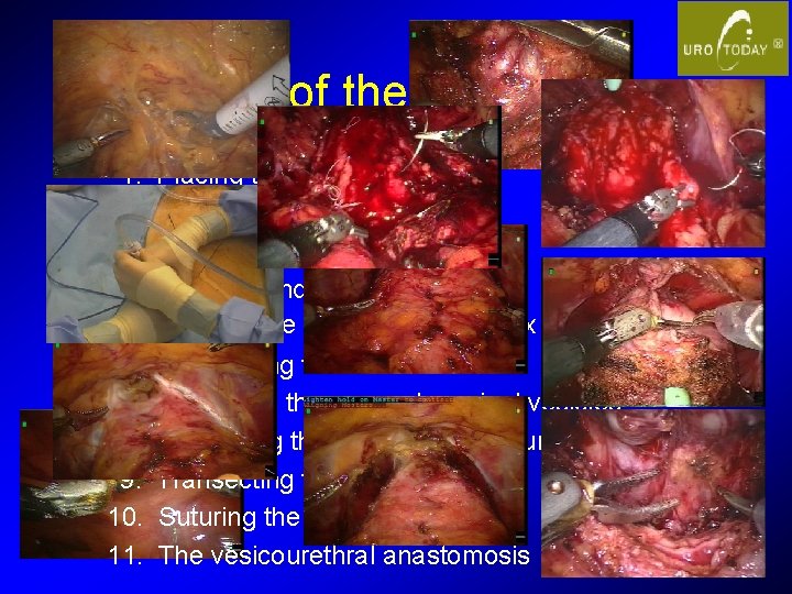 Steps of the procedure 1. 2. 3. 4. 5. 6. 7. 8. 9. 10.