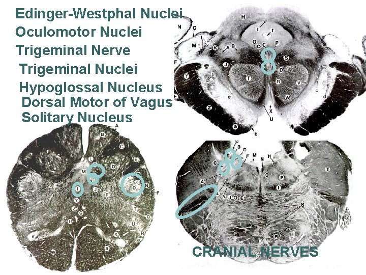 Edinger-Westphal Nuclei Oculomotor Nuclei Trigeminal Nerve Trigeminal Nuclei Hypoglossal Nucleus Dorsal Motor of Vagus