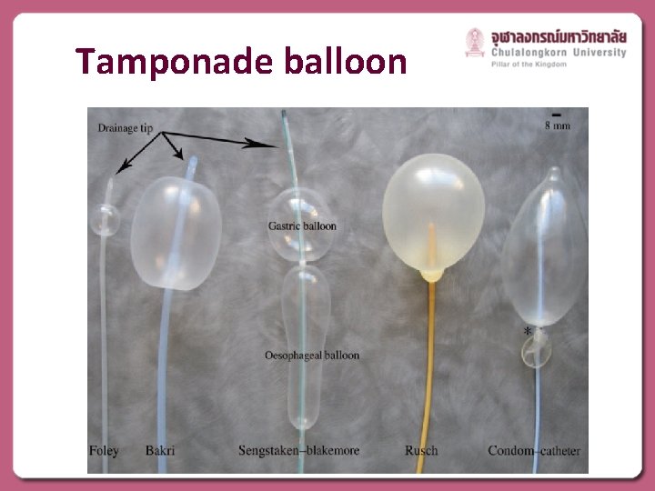 Tamponade balloon 
