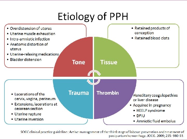 Etiology of PPH • • • Overdistension of uterus Uterine muscle exhaustion Intra-amniotic infection