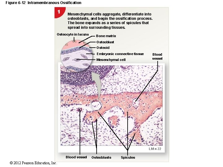 Figure 6 -12 Intramembranous Ossification Mesenchymal cells aggregate, differentiate into osteoblasts, and begin the