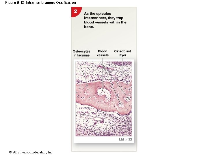 Figure 6 -12 Intramembranous Ossification © 2012 Pearson Education, Inc. 