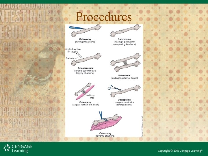 Procedures 