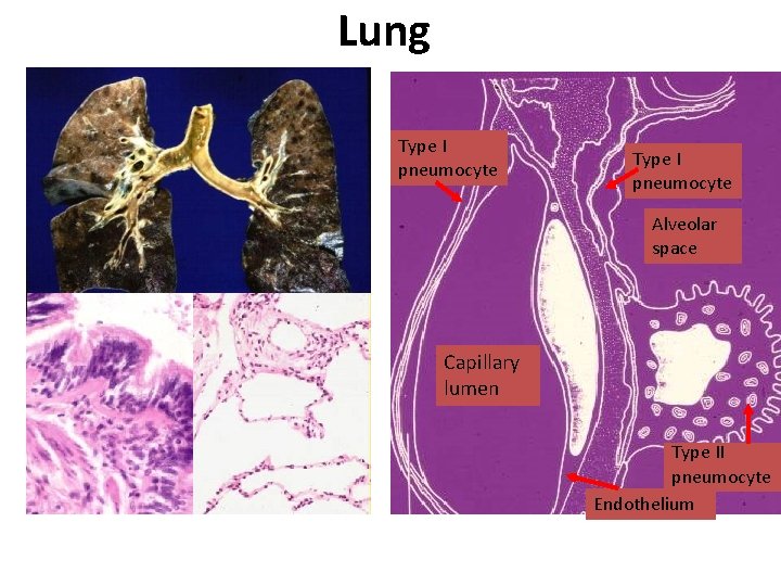 Lung Type I pneumocyte Alveolar space Capillary lumen Type II pneumocyte Endothelium 