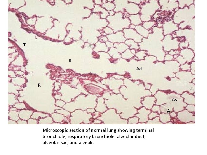 T R Ad R As A Microscopic section of normal lung showing terminal bronchiole,