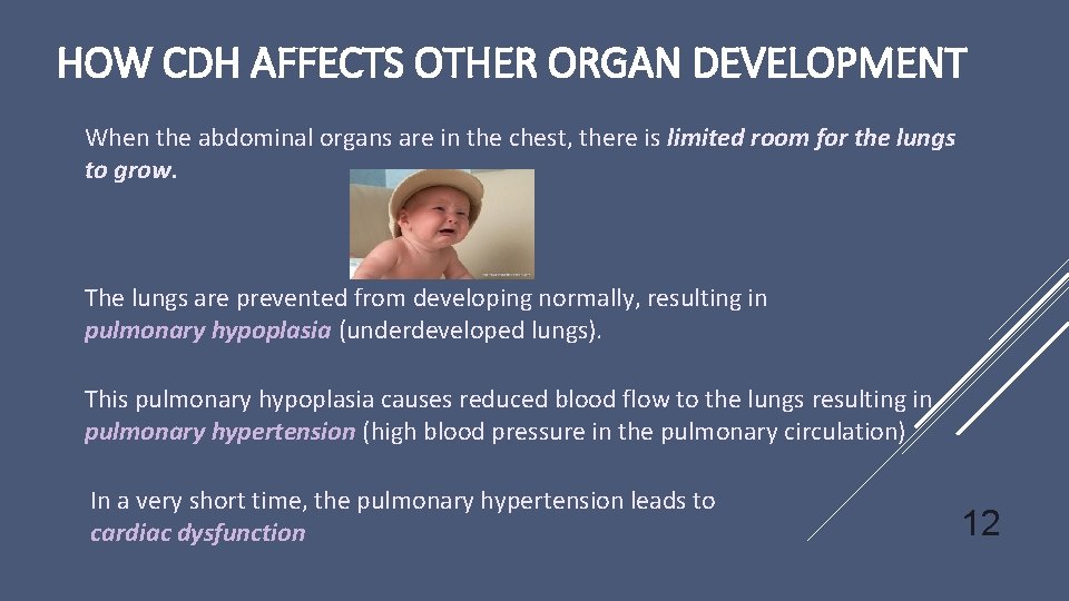 HOW CDH AFFECTS OTHER ORGAN DEVELOPMENT When the abdominal organs are in the chest,