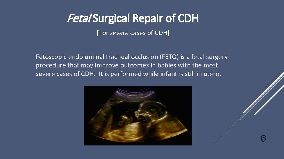 Fetal Surgical Repair of CDH [For severe cases of CDH] Fetoscopic endoluminal tracheal occlusion
