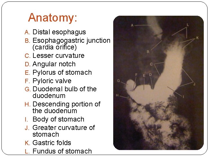 Anatomy: A. Distal esophagus B. Esophagogastric junction (cardia orifice) C. Lesser curvature D. Angular
