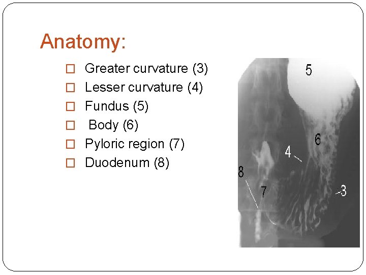 Anatomy: � Greater curvature (3) � Lesser curvature (4) � Fundus (5) Body (6)