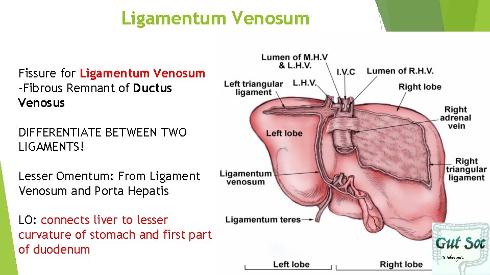 Ligamentum Venosum Fissure for Ligamentum Venosum -Fibrous Remnant of Ductus Venosus DIFFERENTIATE BETWEEN TWO