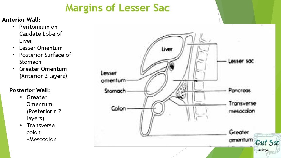 Margins of Lesser Sac Anterior Wall: • Peritoneum on Caudate Lobe of Liver •