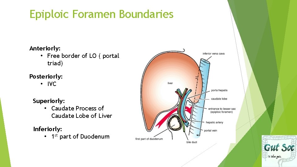Epiploic Foramen Boundaries Anteriorly: • Free border of LO ( portal triad) Posteriorly: •
