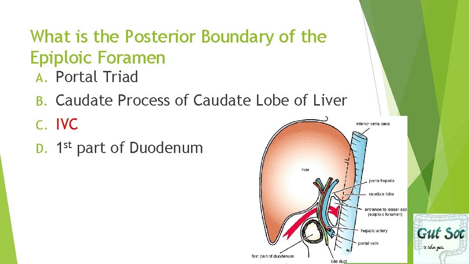 What is the Posterior Boundary of the Epiploic Foramen A. Portal Triad B. Caudate