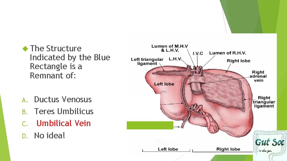  The Structure Indicated by the Blue Rectangle is a Remnant of: Ductus Venosus