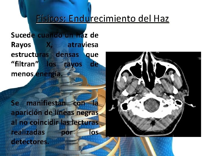 Físicos: Endurecimiento del Haz Sucede cuando un haz de Rayos X, atraviesa estructuras densas