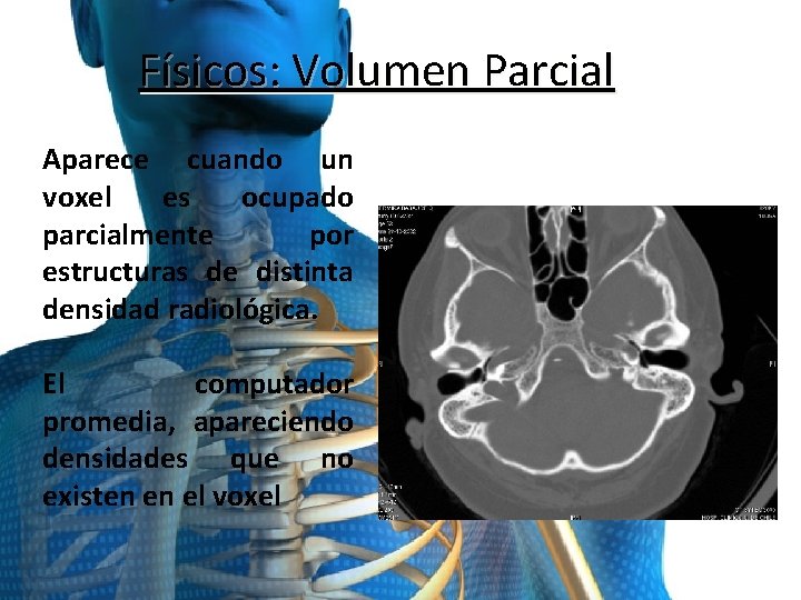 Físicos: Volumen Parcial Aparece cuando un voxel es ocupado parcialmente por estructuras de distinta
