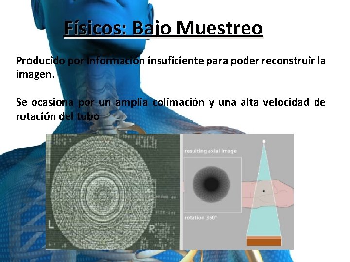 Físicos: Bajo Muestreo Producido por Información insuficiente para poder reconstruir la imagen. Se ocasiona