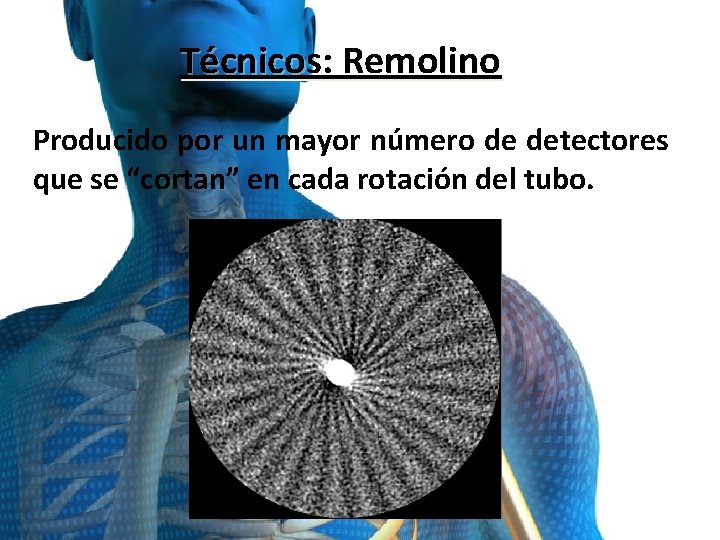 Técnicos: Remolino Producido por un mayor número de detectores que se “cortan” en cada