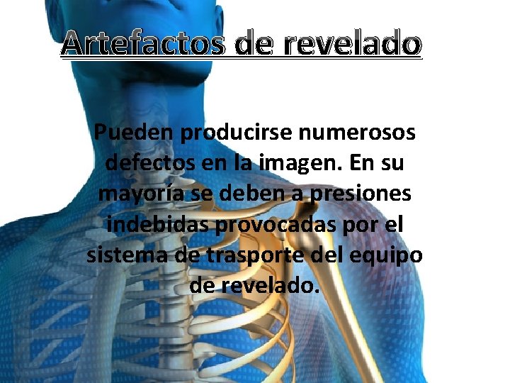 Artefactos de revelado Pueden producirse numerosos defectos en la imagen. En su mayoría se