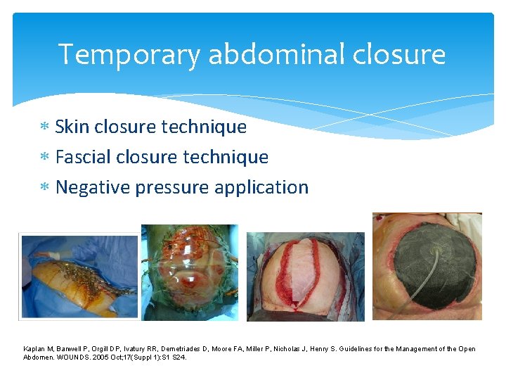 Temporary abdominal closure Skin closure technique Fascial closure technique Negative pressure application Kaplan M, Temporary abdominal closure Skin closure technique Fascial closure technique Negative pressure application Kaplan M,
