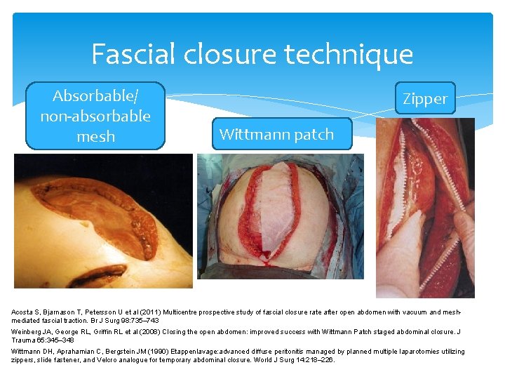Fascial closure technique Absorbable/ non-absorbable mesh Zipper Wittmann patch Acosta S, Bjarnason T, Petersson Fascial closure technique Absorbable/ non-absorbable mesh Zipper Wittmann patch Acosta S, Bjarnason T, Petersson