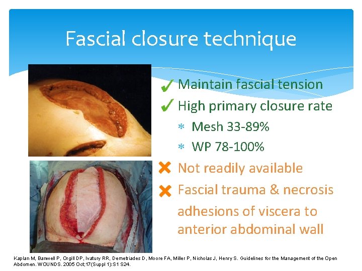 Fascial closure technique Maintain fascial tension High primary closure rate Mesh 33 -89% WP Fascial closure technique Maintain fascial tension High primary closure rate Mesh 33 -89% WP