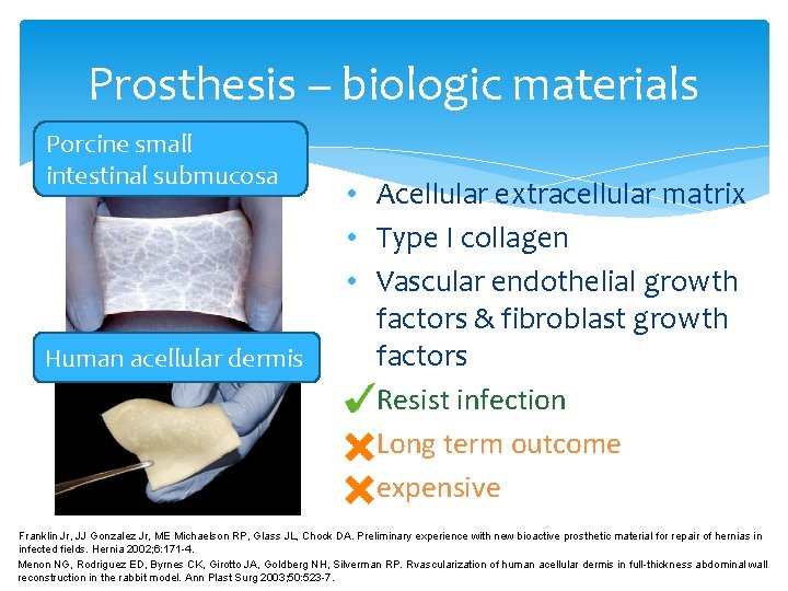Prosthesis – biologic materials Porcine small intestinal submucosa Human acellular dermis • Acellular extracellular Prosthesis – biologic materials Porcine small intestinal submucosa Human acellular dermis • Acellular extracellular