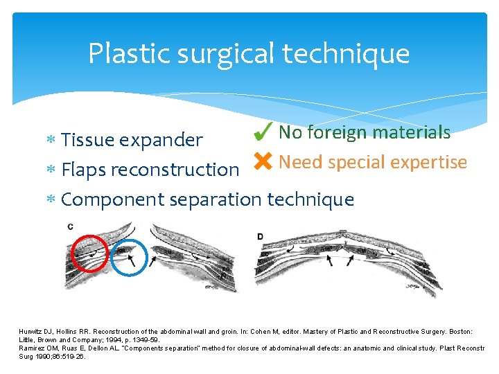 Plastic surgical technique No foreign materials Tissue expander Need special expertise Flaps reconstruction Component Plastic surgical technique No foreign materials Tissue expander Need special expertise Flaps reconstruction Component
