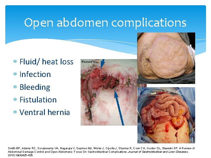 Open abdomen complications Fluid/ heat loss Infection Bleeding Fistulation Ventral hernia Smith BP, Adams Open abdomen complications Fluid/ heat loss Infection Bleeding Fistulation Ventral hernia Smith BP, Adams