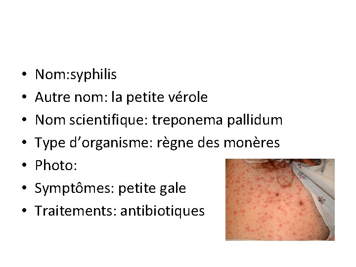  • • Nom: syphilis Autre nom: la petite vérole Nom scientifique: treponema pallidum