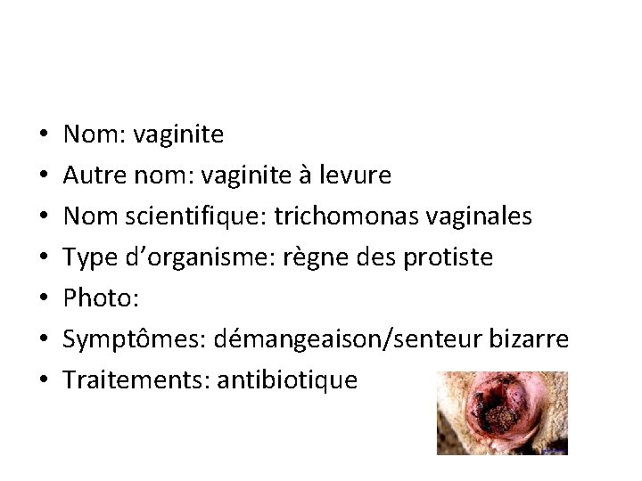  • • Nom: vaginite Autre nom: vaginite à levure Nom scientifique: trichomonas vaginales