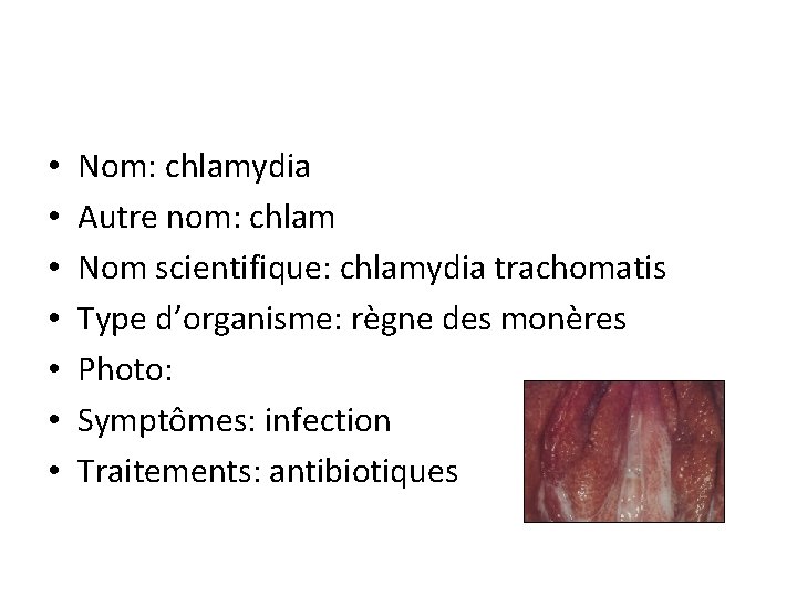  • • Nom: chlamydia Autre nom: chlam Nom scientifique: chlamydia trachomatis Type d’organisme: