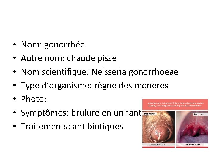  • • Nom: gonorrhée Autre nom: chaude pisse Nom scientifique: Neisseria gonorrhoeae Type