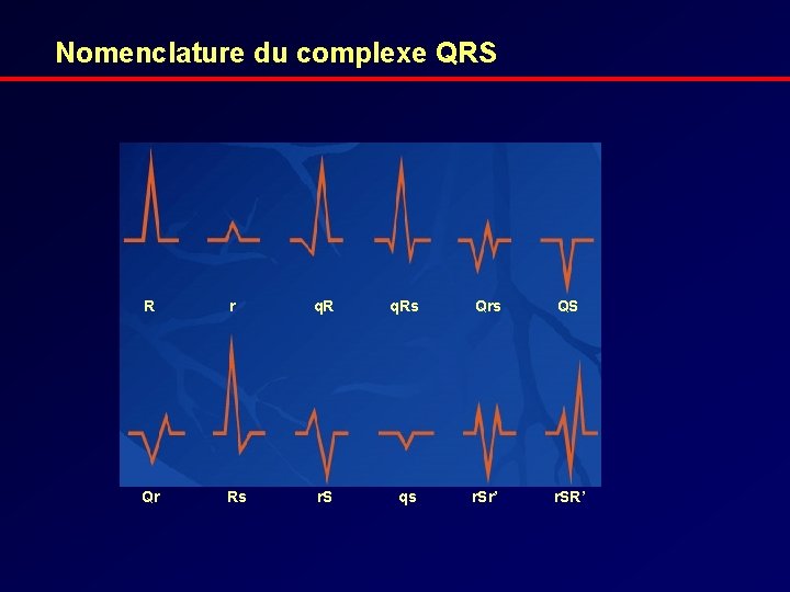 Nomenclature du complexe QRS R r q. Rs Qrs QS Qr Rs r. S