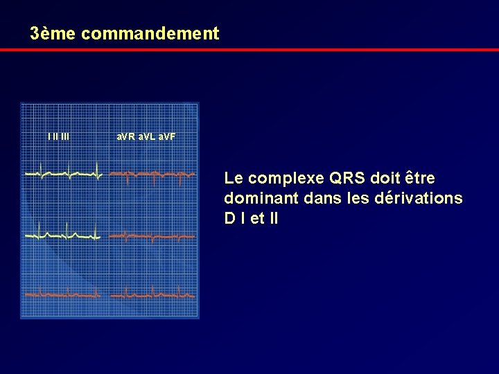 3ème commandement I II III a. VR a. VL a. VF Le complexe QRS