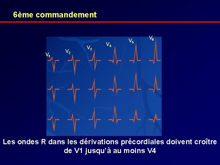 6ème commandement V 1 V 2 V 3 V 4 V 5 V 6