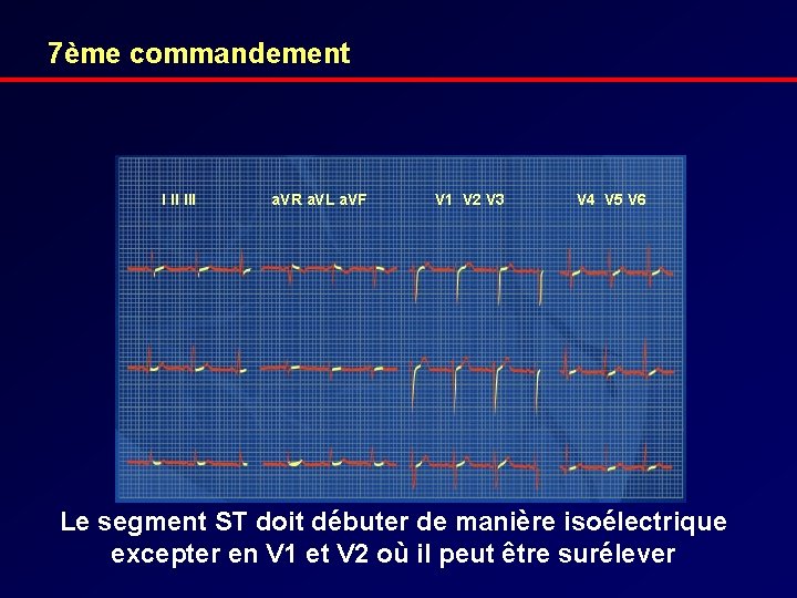 7ème commandement I II III a. VR a. VL a. VF V 1 V