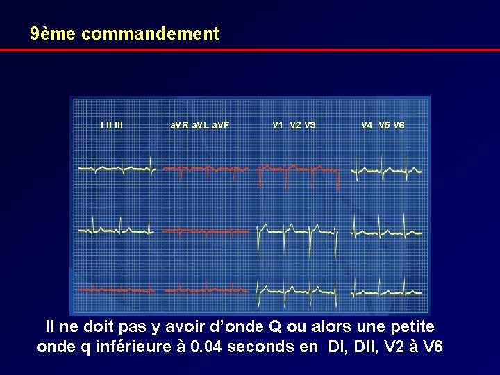 9ème commandement I II III a. VR a. VL a. VF V 1 V