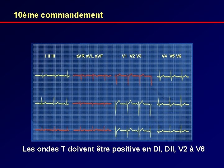 10ème commandement I II III a. VR a. VL a. VF V 1 V